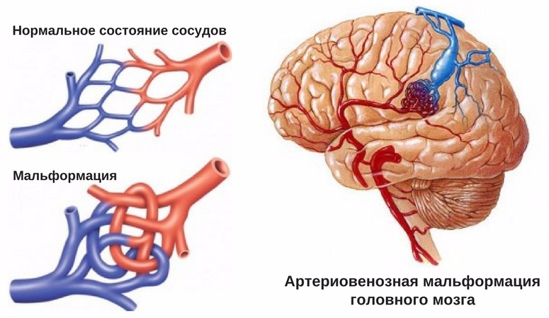 Ограничение доступа